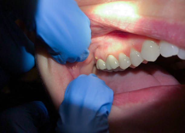Best Emergency Dental Surgery in Wrightstown, WI