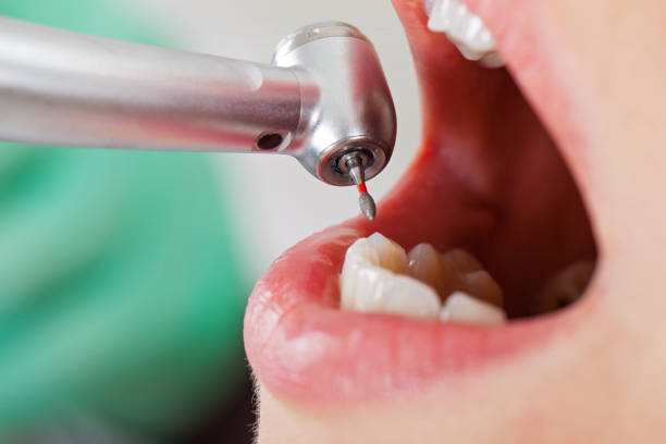 Best Emergency Root Canal Treatment in Wrightstown, WI